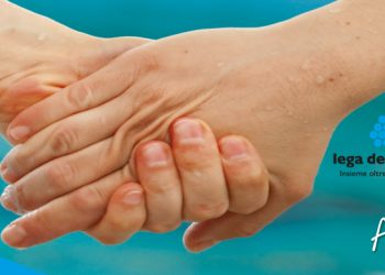 SERVIZIO CIVILE UNIVERSALE ALLA LEGA DEL FILO D’ORO E CORSO BASE – scade 10 febbraio